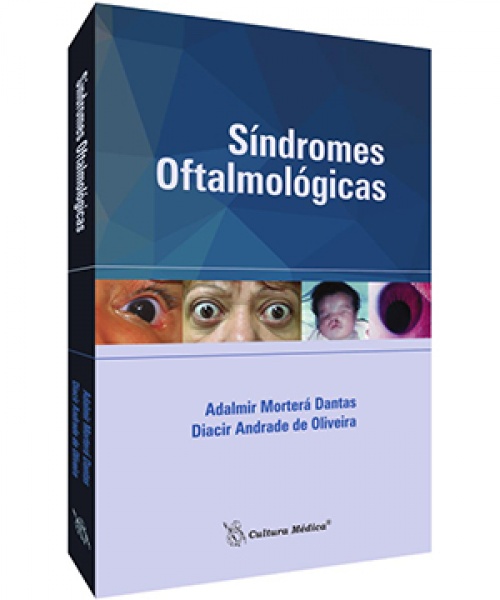 Síndromes Oftalmológicas