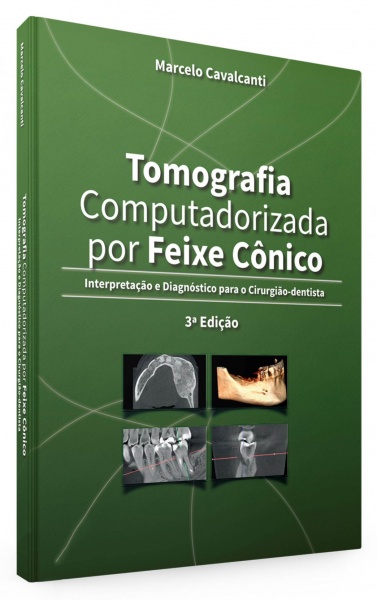Tomografia Computadorizada Por Feixe Cônico - Interpretação E Diagnóstico Para O Cirurgião-Dentista - 3ª Edição