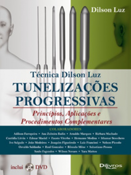 Tunelizações Progressivas - Princípios, Aplicações E Procedimentos Complementares