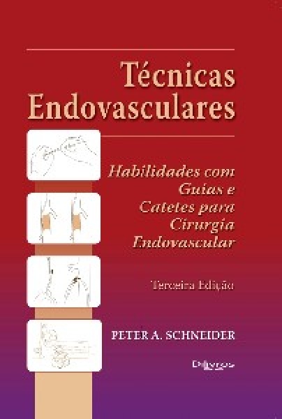 Técnicas Endovasculares