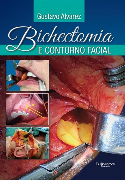 Bichectomia E Contorno Facial