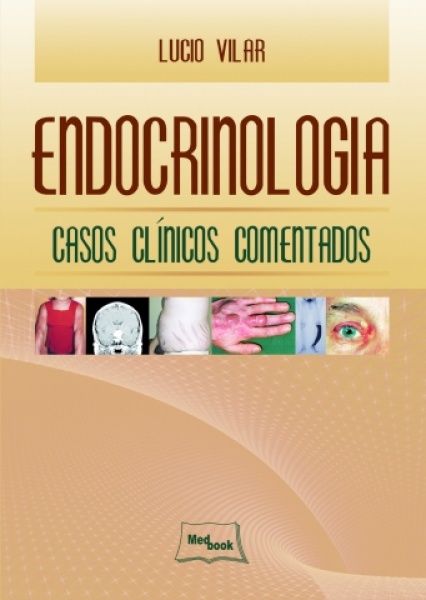 Endocrinologia  Casos Clínicos Comentados