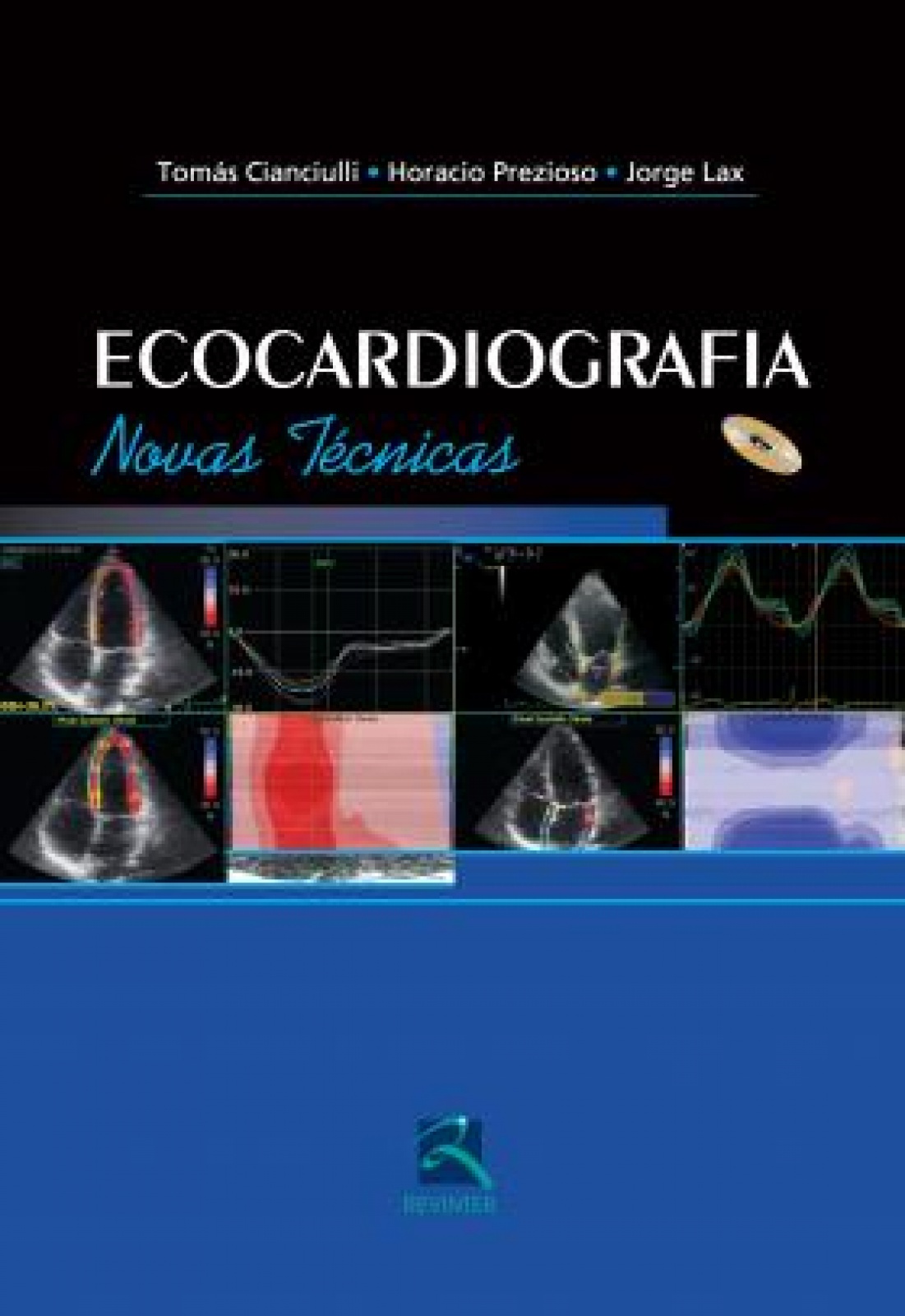Ecocardiografia Novas Técnicas