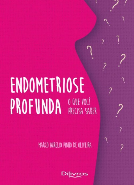 Endometriose Profunda O Que Você Precisa Saber