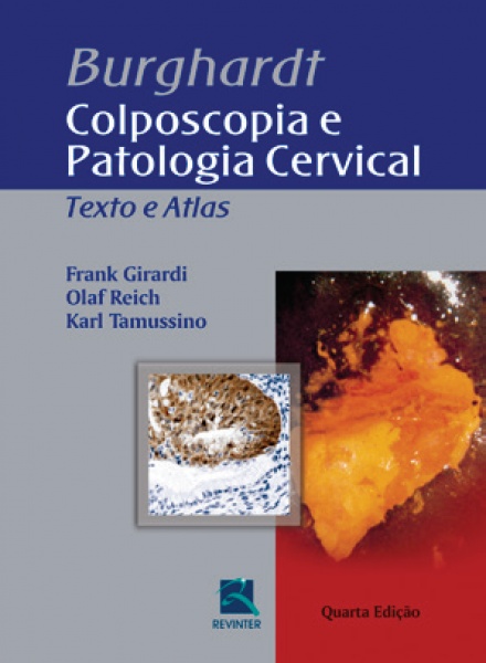 Burghardt - Colposcopia E Patologia Cervical - Texto E Atlas, 4ª Edição