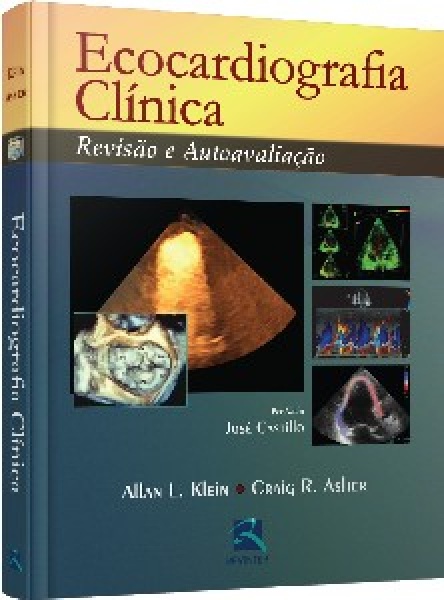 Ecocardiografia Clínica - Revisão E Autoavaliação