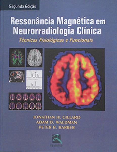 Ressonância Magnética Em Neurorradiologia Clínica Técnicas Fisiológicas E Funcionais