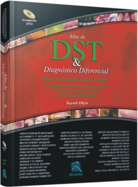 Atlas De Dst & Diagnóstico Diferencial, 2ª Edição