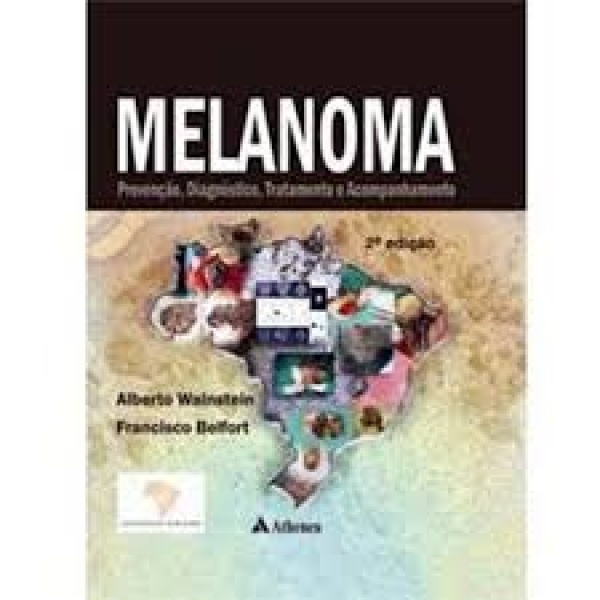 Melanoma - Prevenção, Diagnóstico, Tratamento E Acompanhamento 