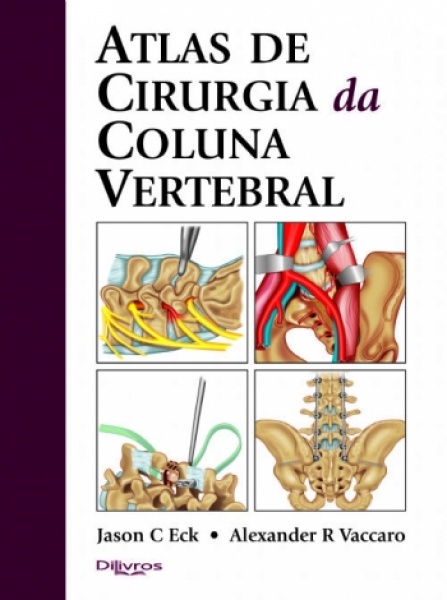 Atlas De Cirurgia Da Coluna Vertebral
