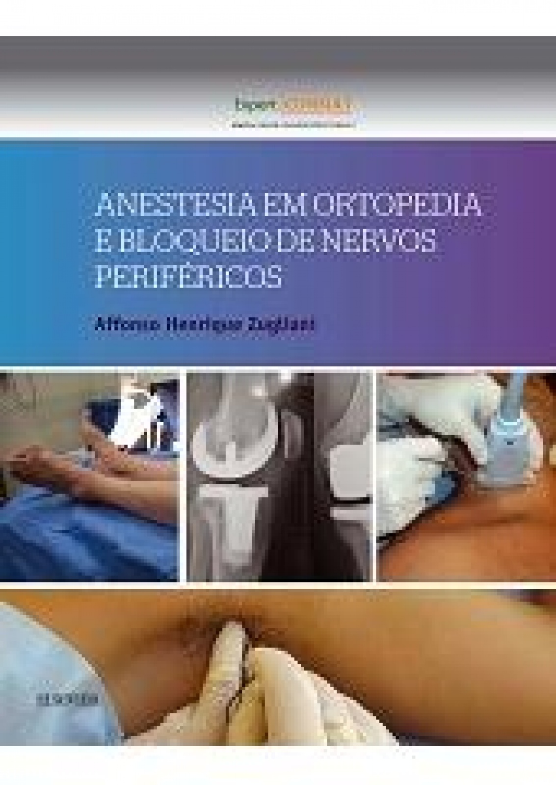 Anestesia Em Ortopedia E Bloqueio De Nervos Periféricos - 1ª Edição 2016