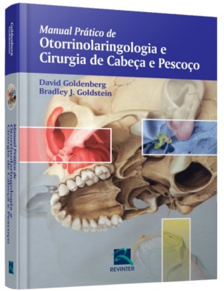 Manual Prático De Otorrinolaringologia  Cirurgia De Cabeça E Pescoço