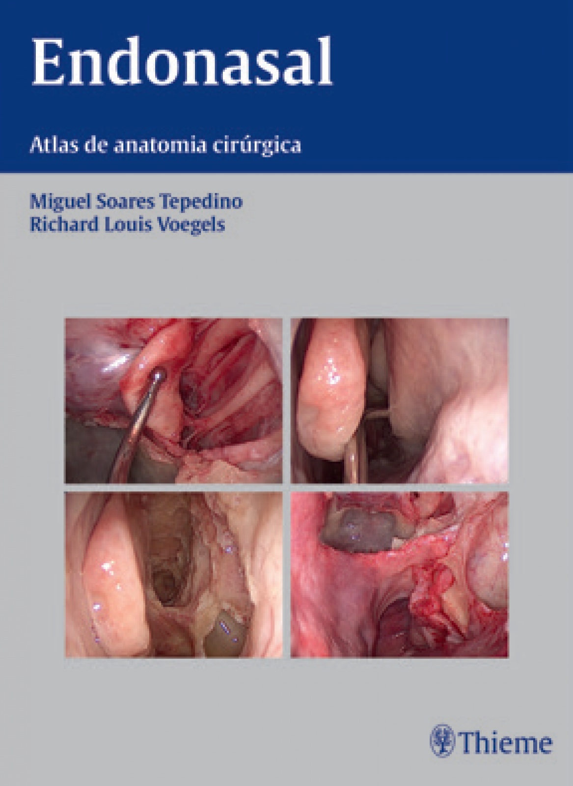 Endonasal: Atlas De Anatomia Cirúrgica