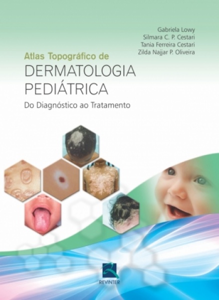 Atlas Topografico De Dermatologia Pediatrica