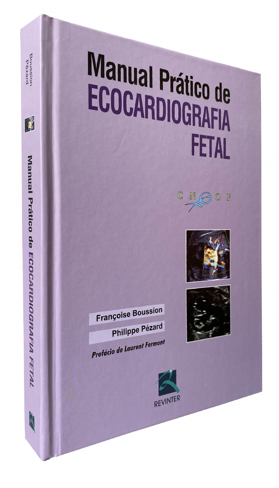 Manual Prático De Ecocardiografia Fetal