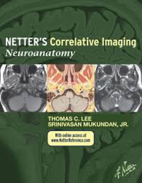 Neuroanatomia Netter’S Correlative Imaging