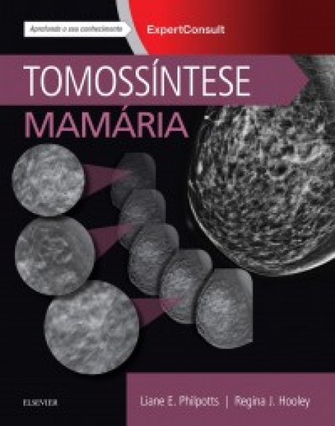 Tomossíntese Mamária- 1A Edição