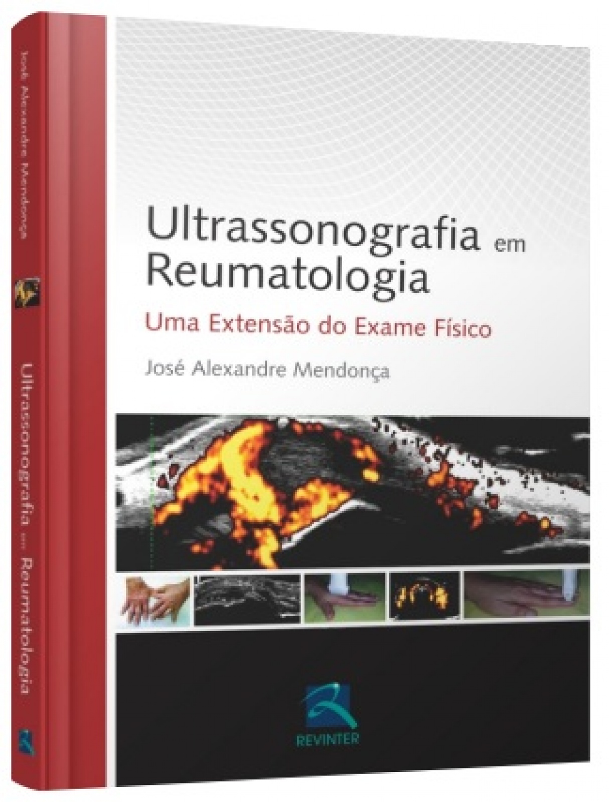 Ultrassonografia Em Reumatologia  Uma Extensão Do Exame Físico