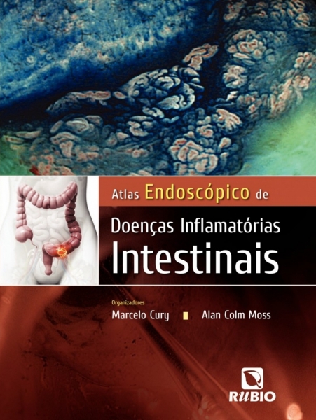 Atlas Endoscópico de Doenças Inflamatórias Intestinais