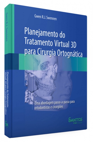 Planejamento Do Tratamento Virtual 3D Para Cirurgia Ortognática