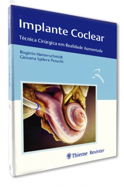Implante Coclear