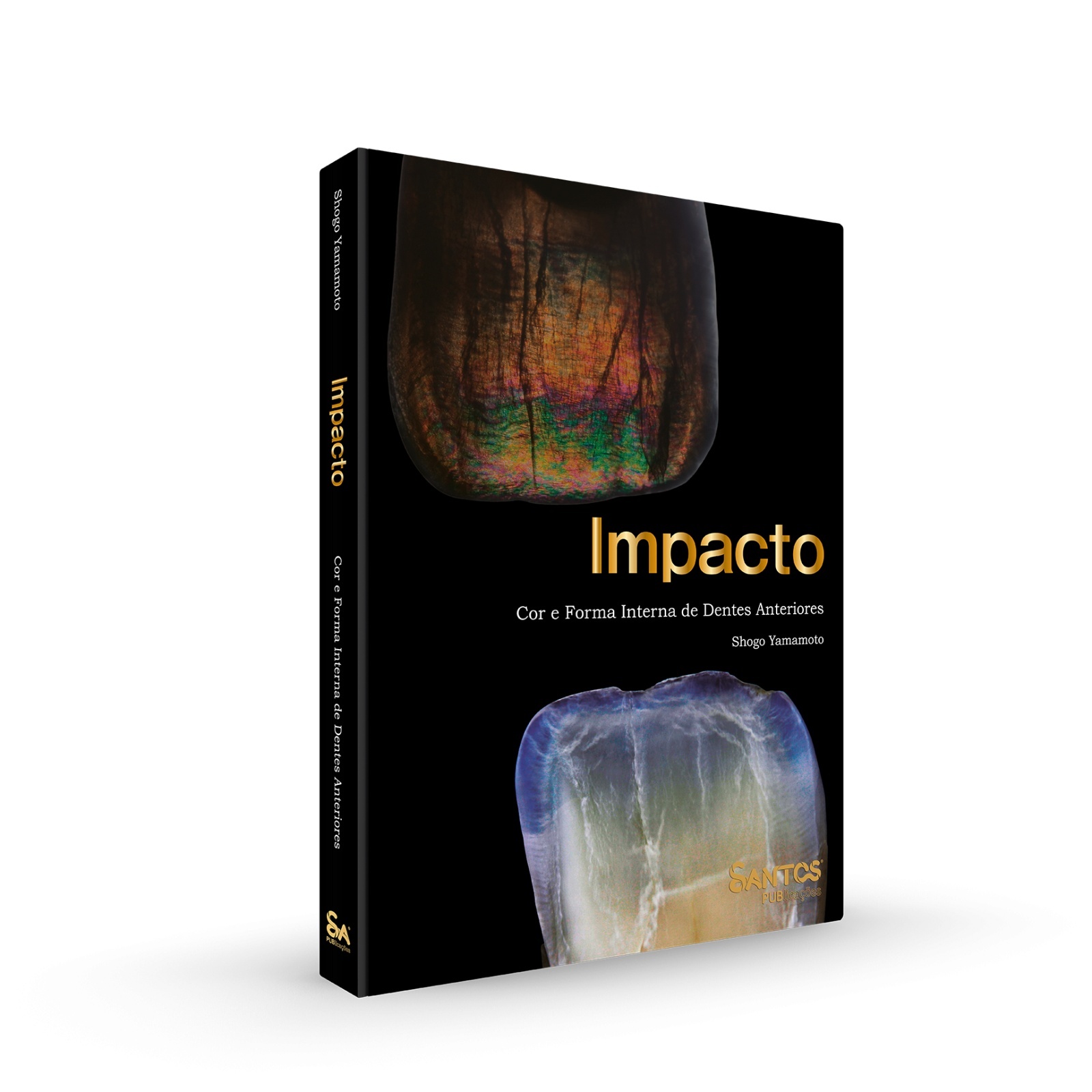 Impacto • Cor E Forma Interna De Dentes Anteriores (Edição Bilingue)