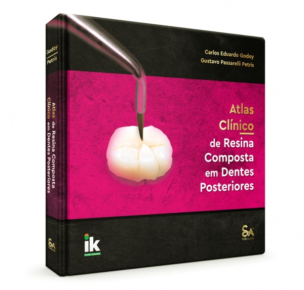 Atlas Clínico De Resina Composta Em Dentes Posteriores