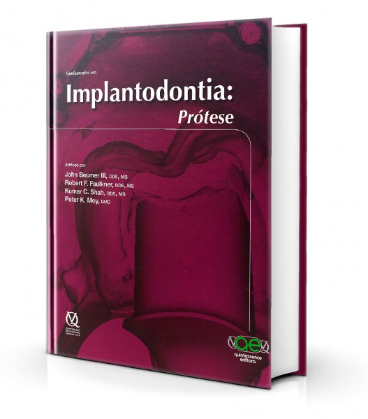 Fundamentos Em Implantodontia: Prótese