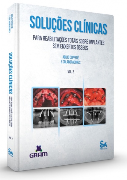 Soluções Clínicas Para Reabilitações Totais Sobre Implantes Sem Enxertos Ósseos - Vol. 2