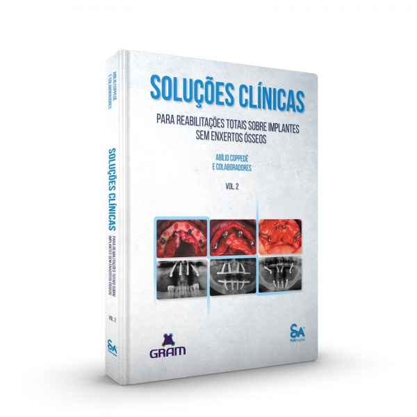 Soluções Clínicas Para Reabilitações Totais Sobre Implantes Sem Enxertos Ósseos - Vol. 2