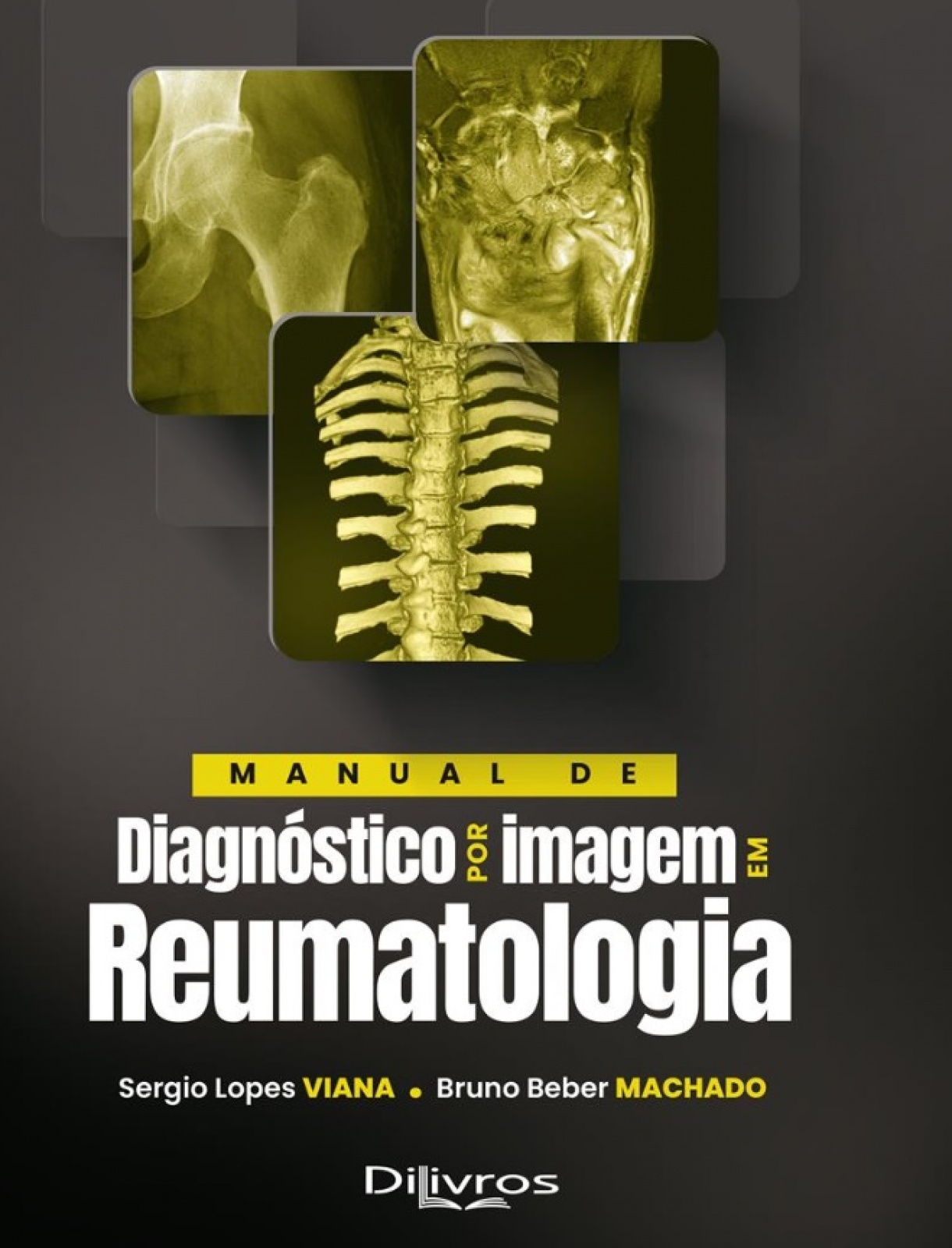 Manual De Diagnóstico Por Imagem Em Reumatologia