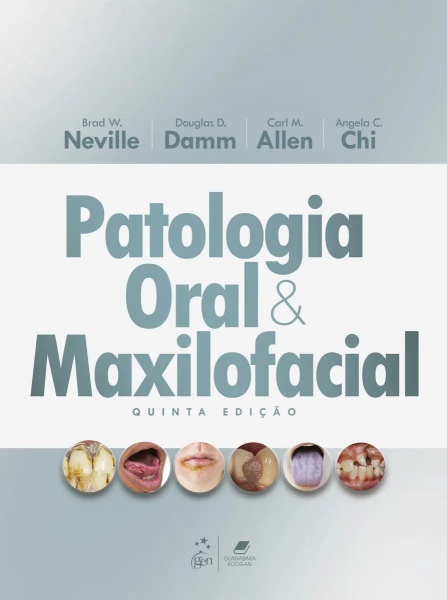 Patologia Oral E Maxilofacial
