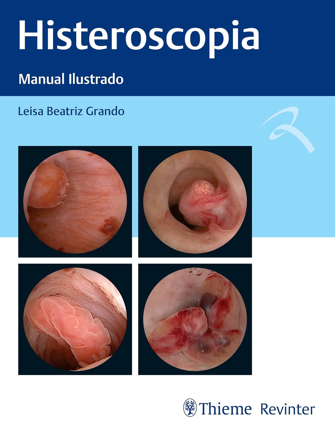 Histeroscopia: Manual Ilustrado.