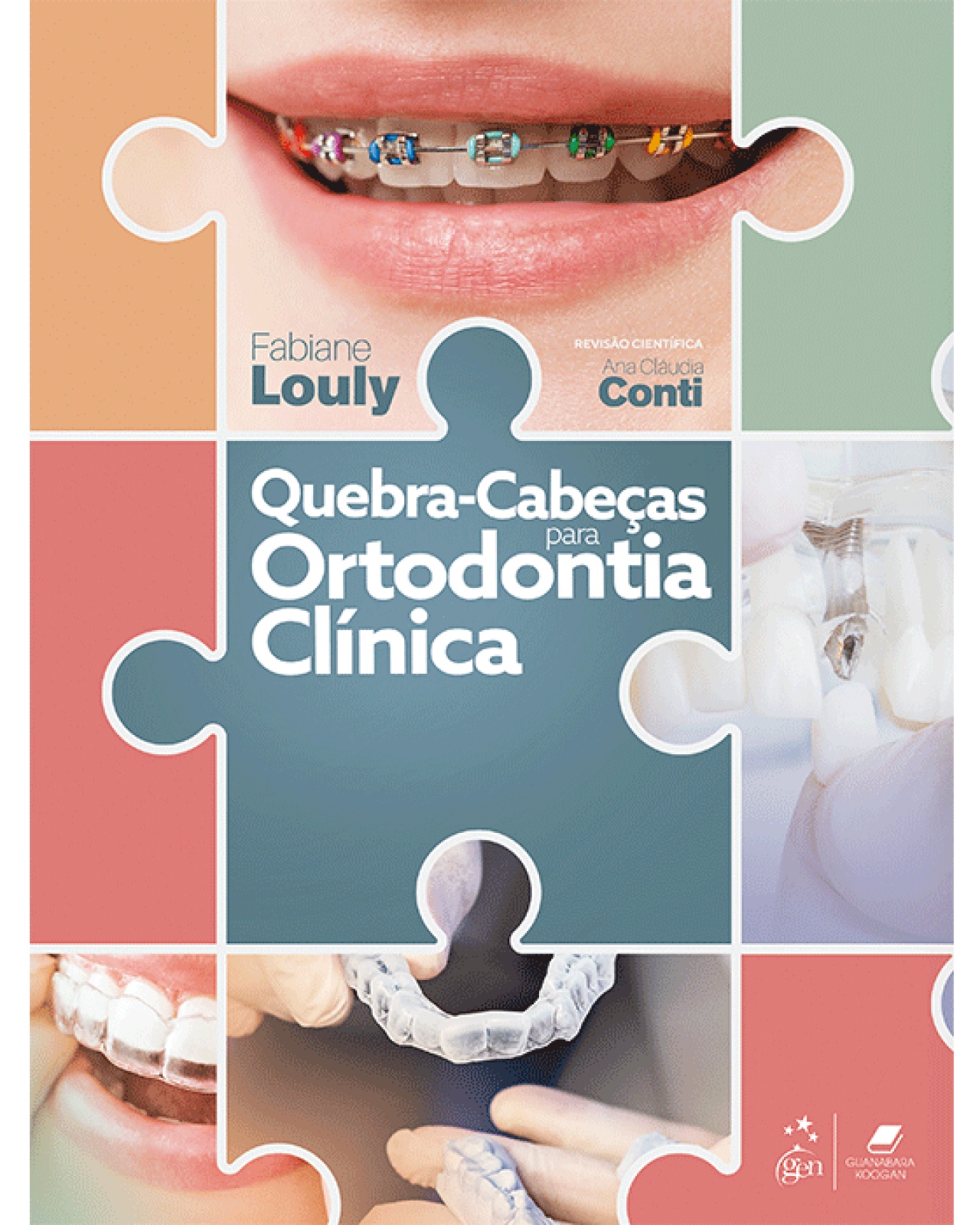 Quebra-Cabeças Para Ortodontia Clínica