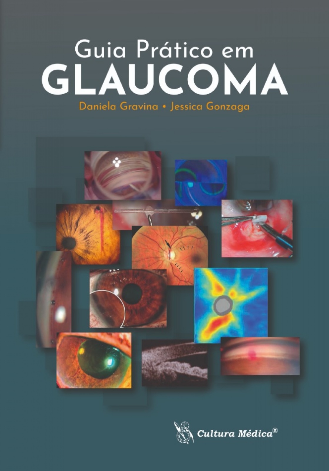 Guia Prático Em Glaucoma