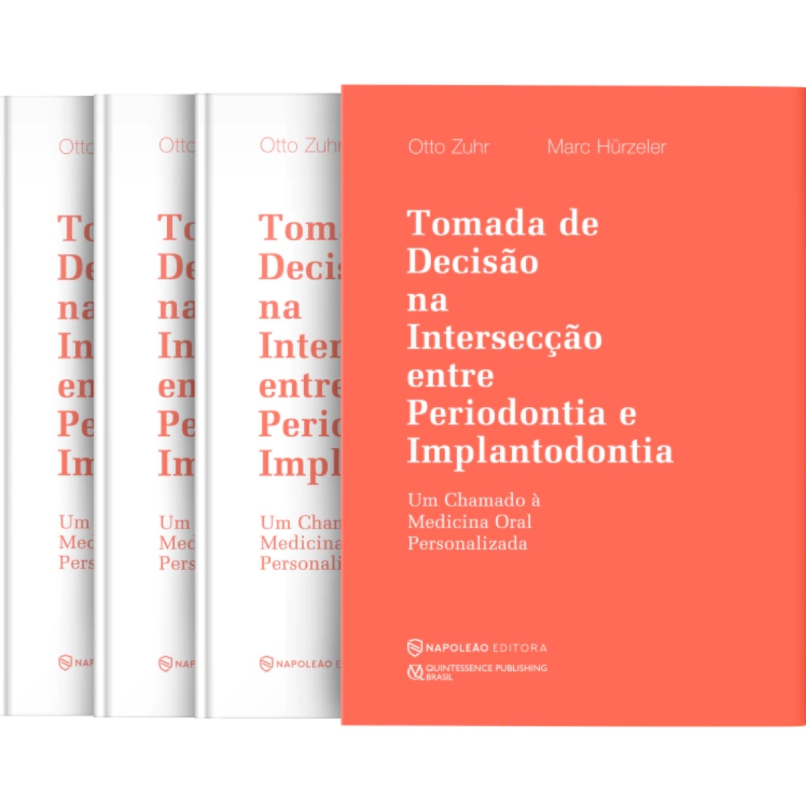 Tomada De Decisão Na Intersecção Entre Periodontia E Implantodontia - Um Chamado À Medicina Oral Personalizada