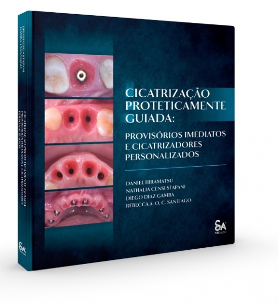 Cicatrização Proteticamente Guiada