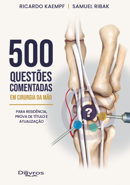 500 Questoes Comentadas Em Cirurgia Da Mao