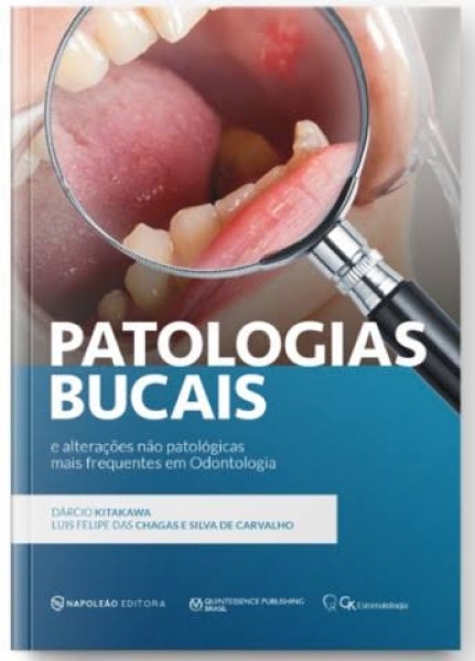 Patologias Bucais E Alterações Não Patológicas Mais Frequentes Em Odontologia
